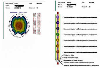 Снимок компьютерной диагностики до приёма гидроплазмы Инюшина.